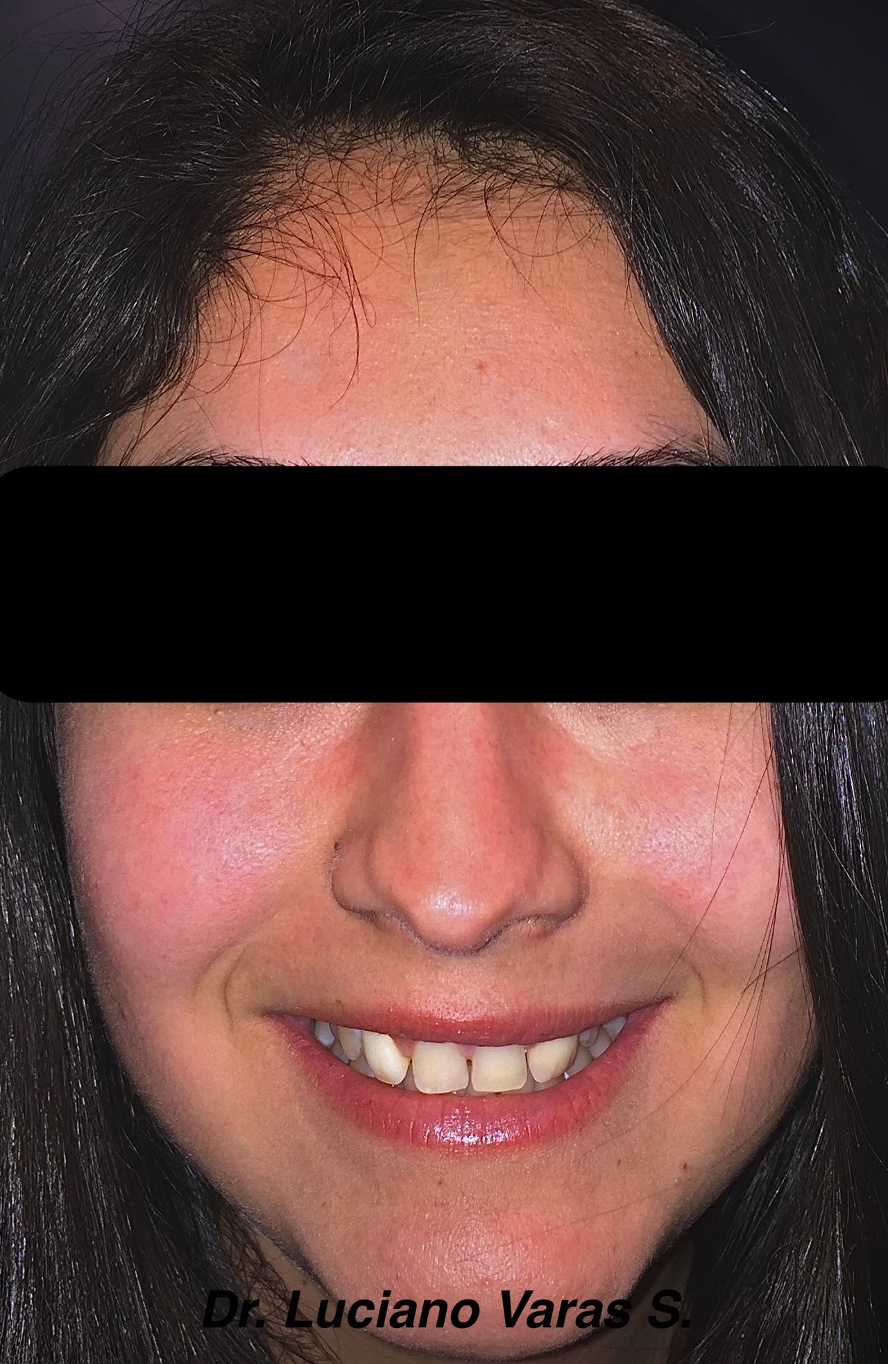 Luciano Varas Salinas-10