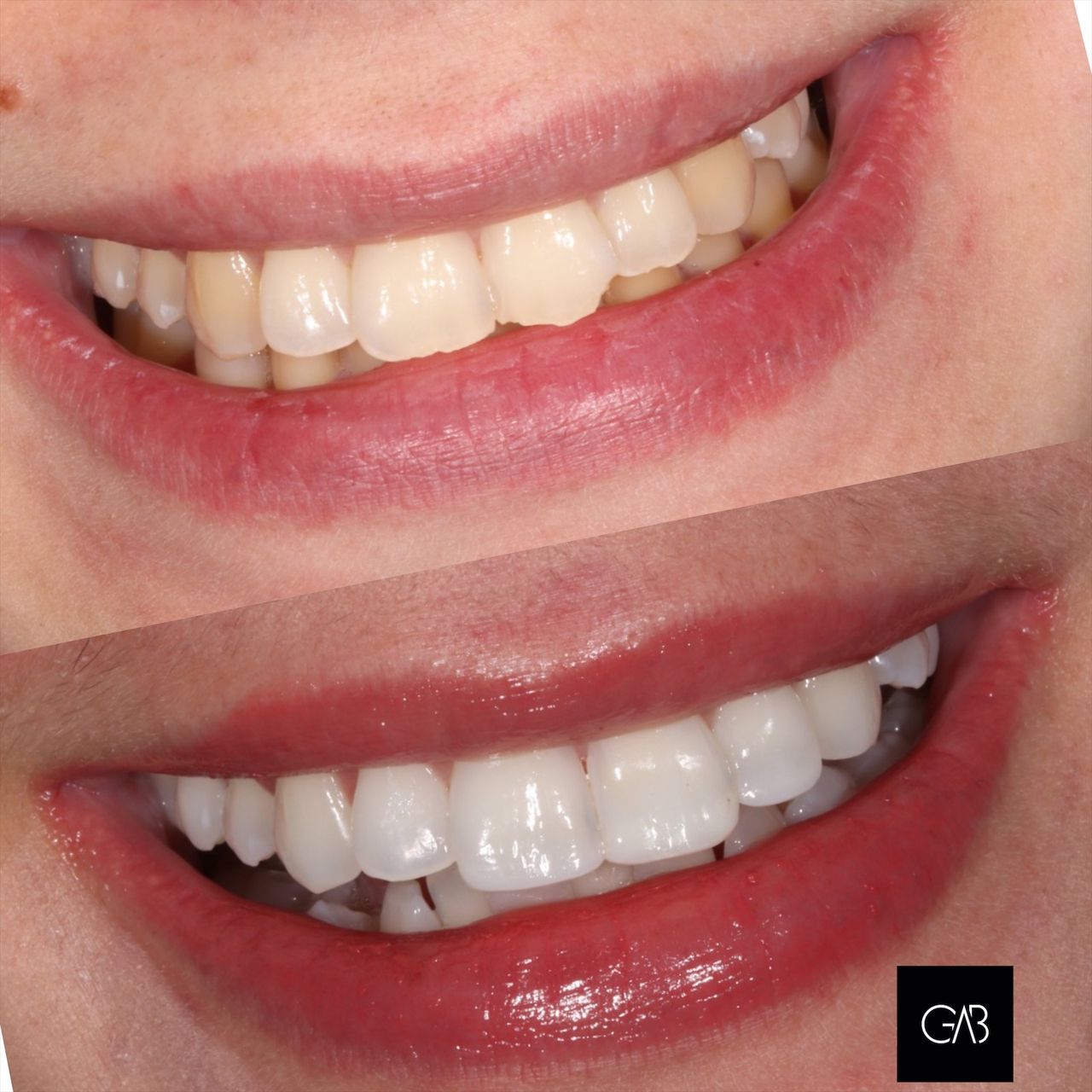 Gabriela Azevedo Barbosa-5