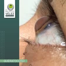 Mauricio Velez Fernandez-5