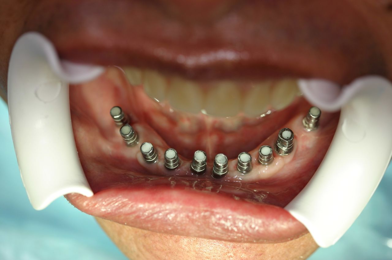 Isail Klahr Averbuch-9