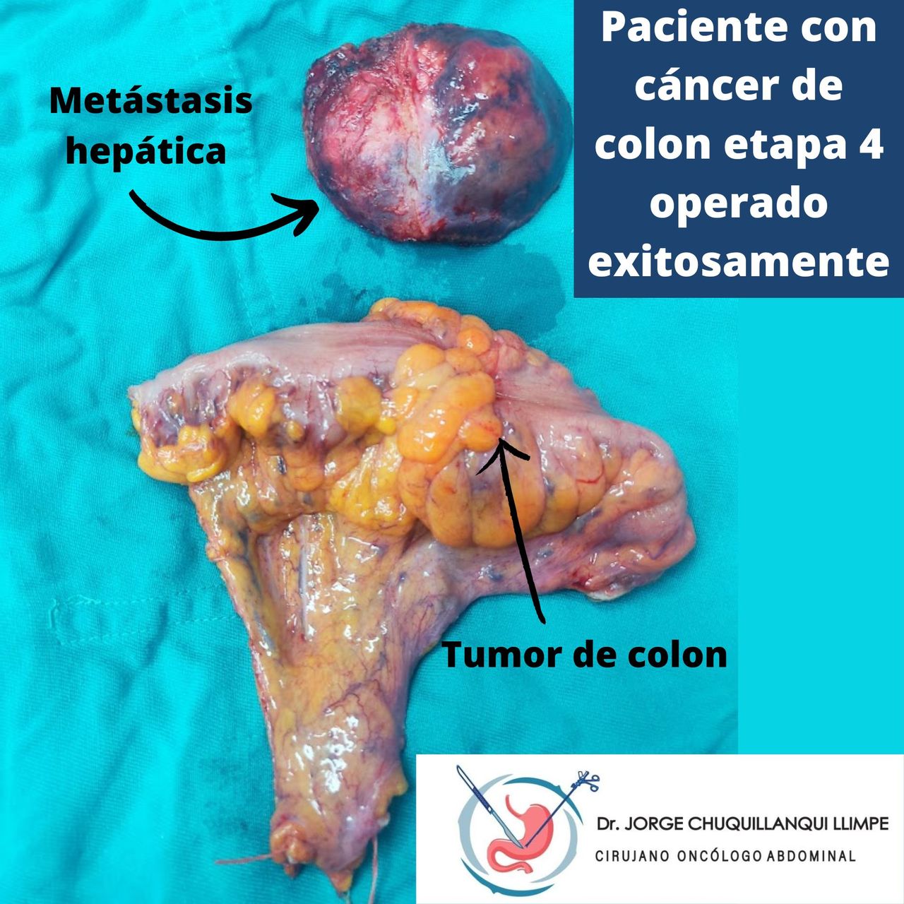 Jorge Chuquillanqui Llimpe-3