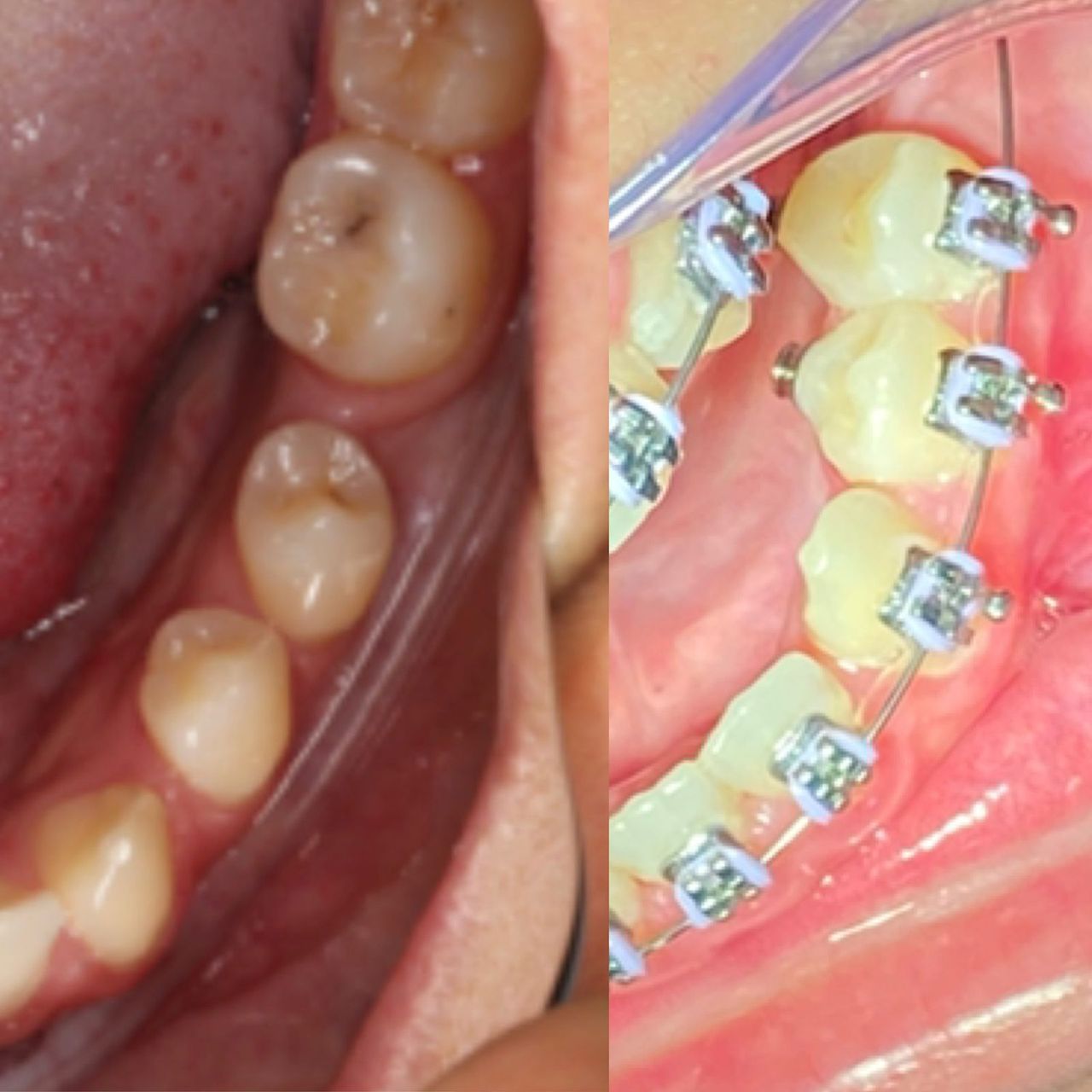 Francisco De Assis Almeida Lima Júnior-24