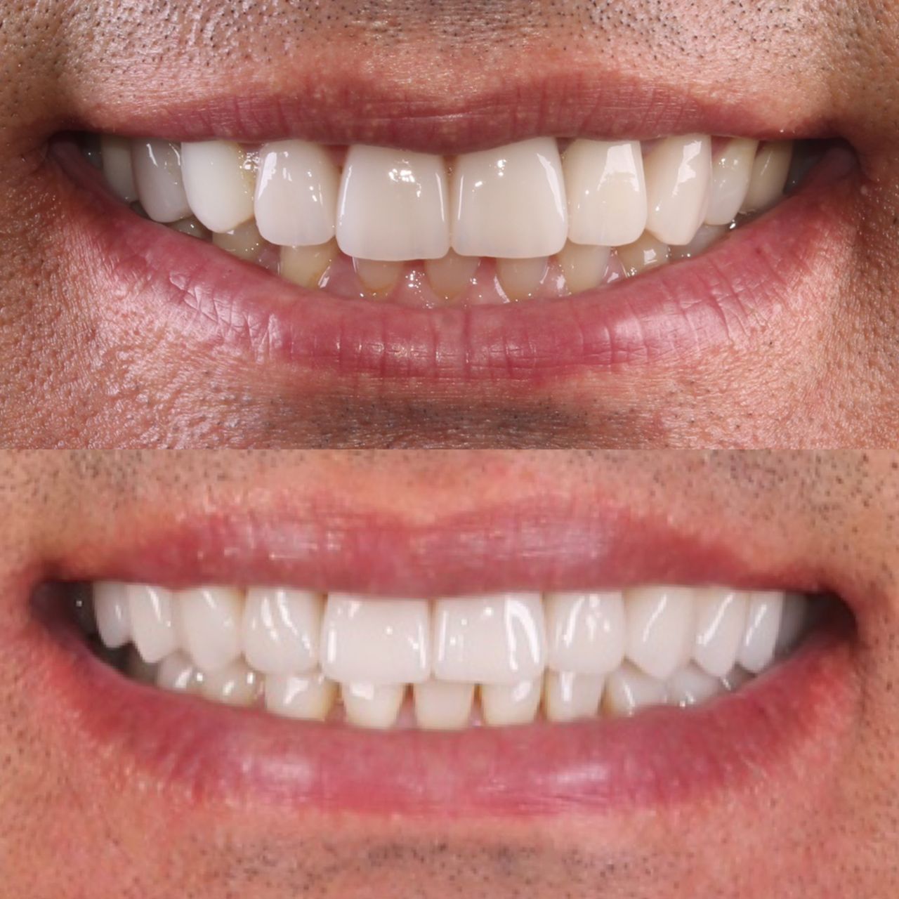 Caroline Benedeti-17