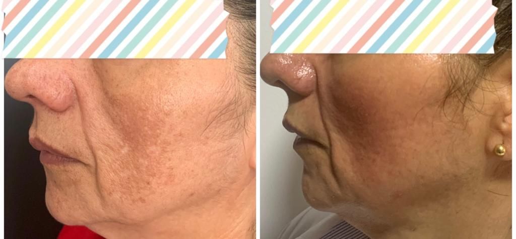 Maria Gisela Angel Losada-33