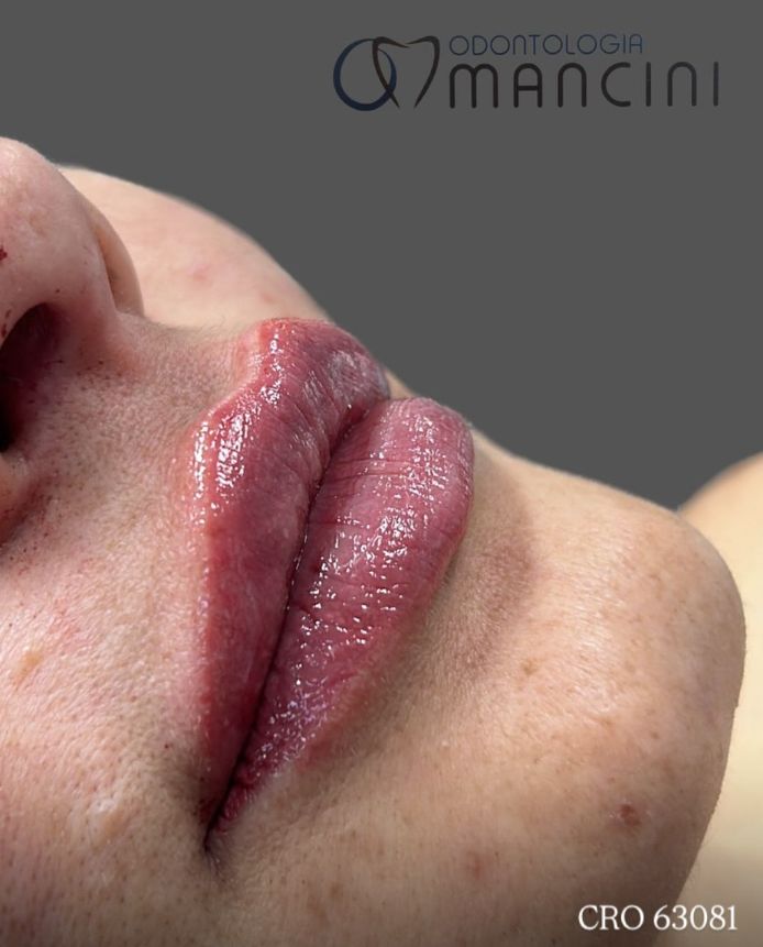 Hermenegildo Mancini-0