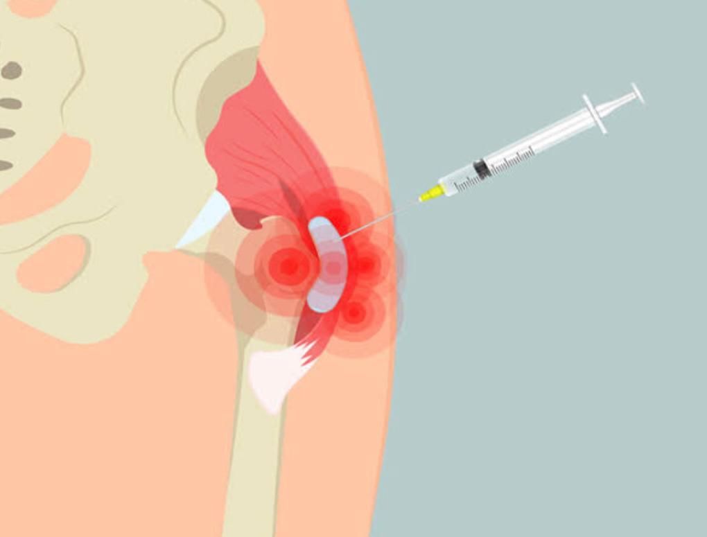 Jônatas Laurindo Giacomini-33