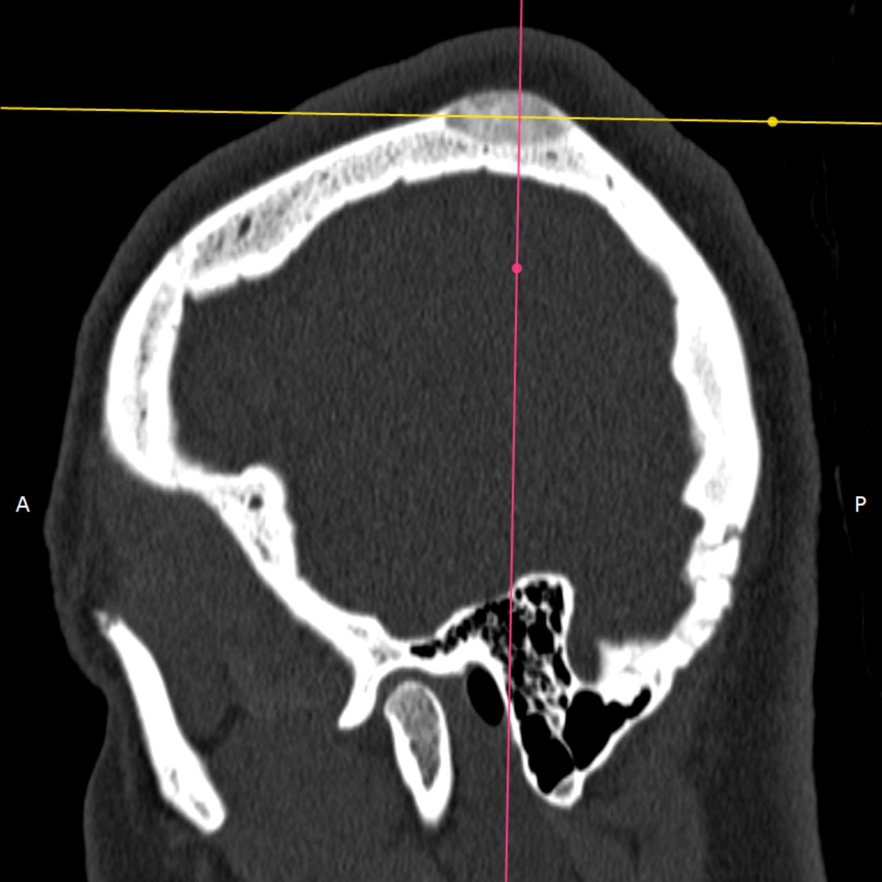 David Tafur Muñoz-2288