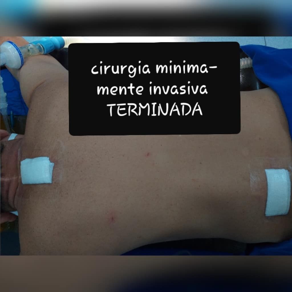 Urbano Chamadoiro-24