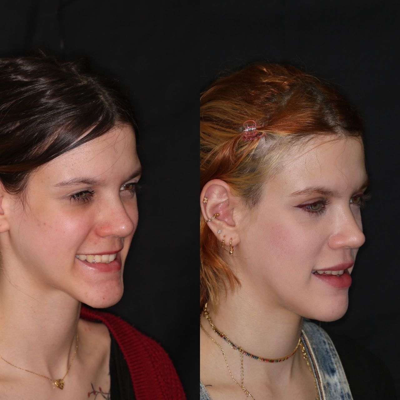 Bruno Nifossi Prado-26