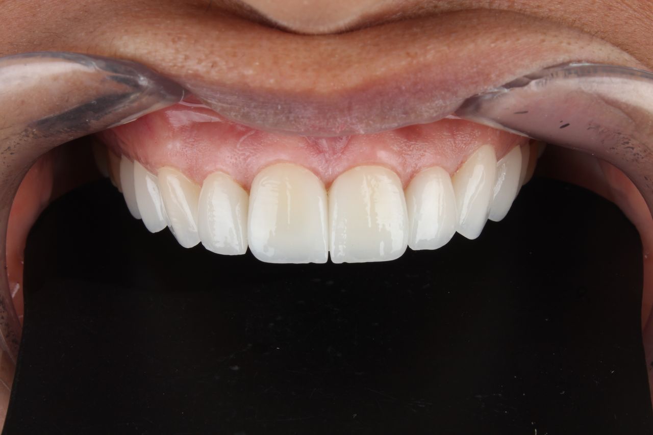 Cristian Pastrana Corrales-20