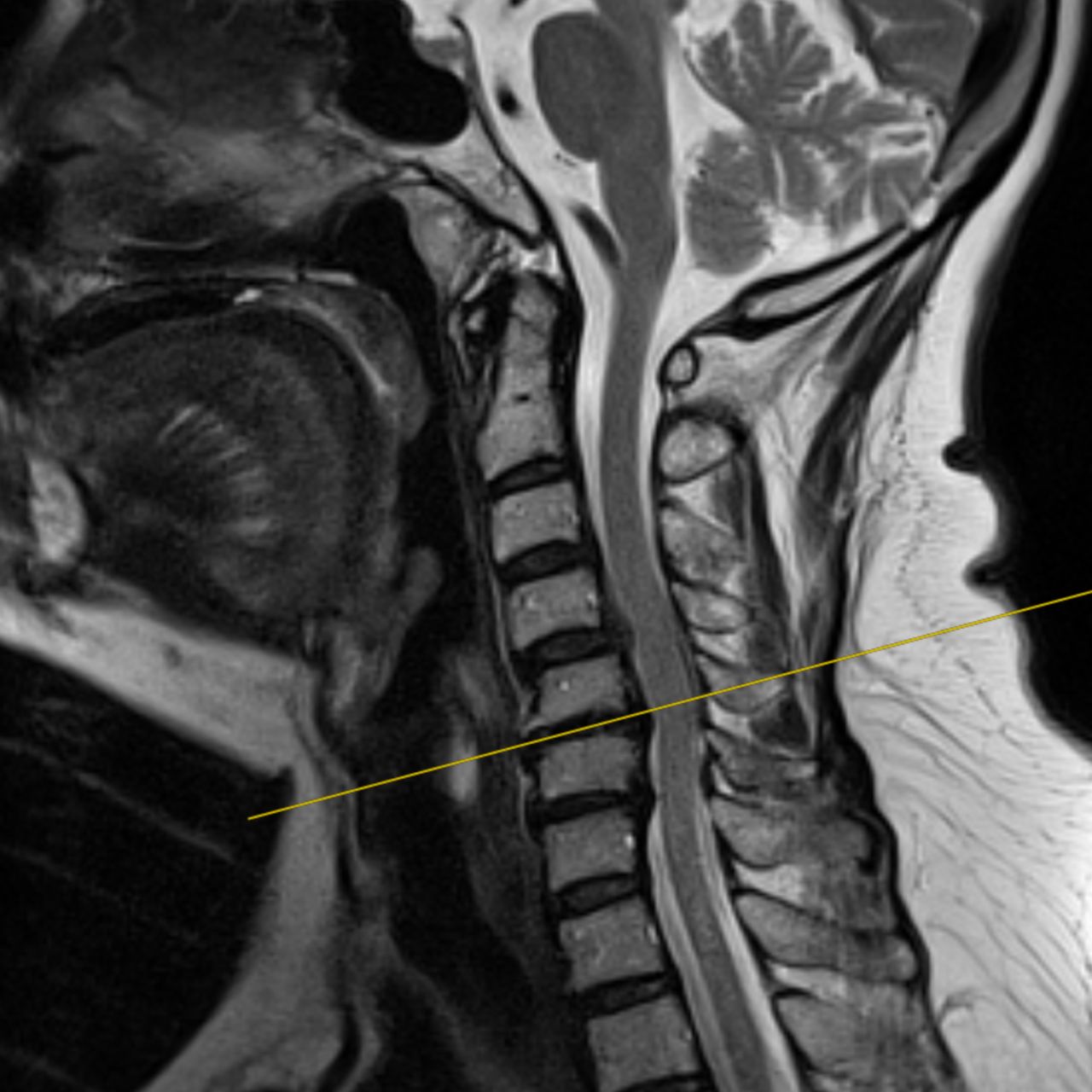 David Tafur Muñoz-1406