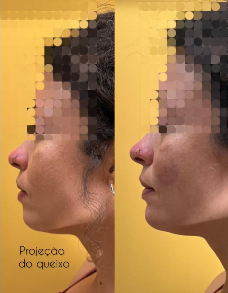 Alana  Meira Silveira Potiguara -3