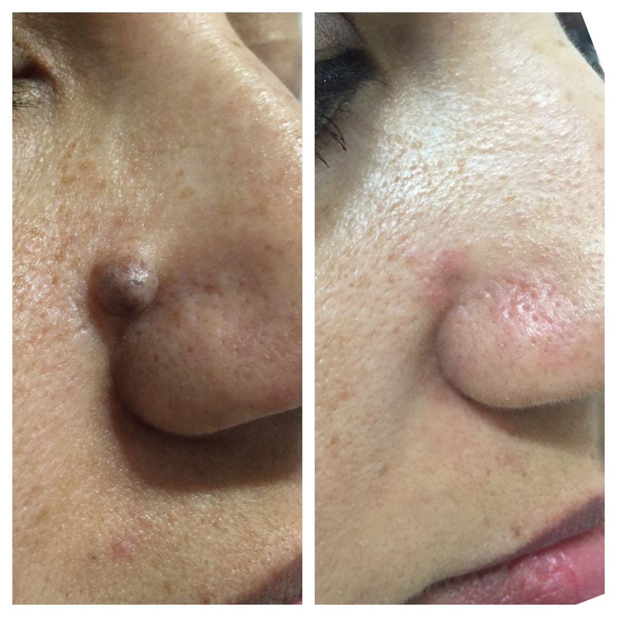 Fernando Oviedo Monsalve-1