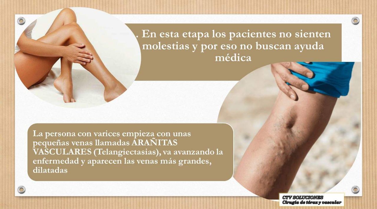 Walter Rodolfo Calle Mendoza-3