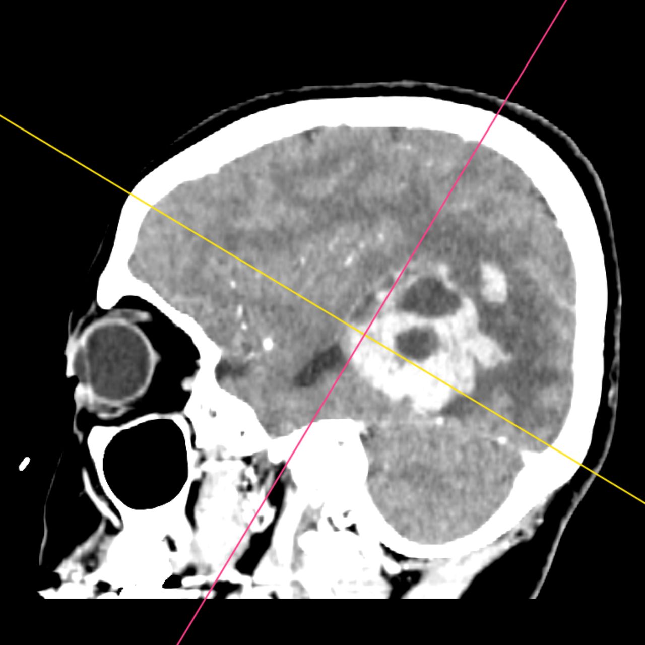 David Tafur Muñoz-1915