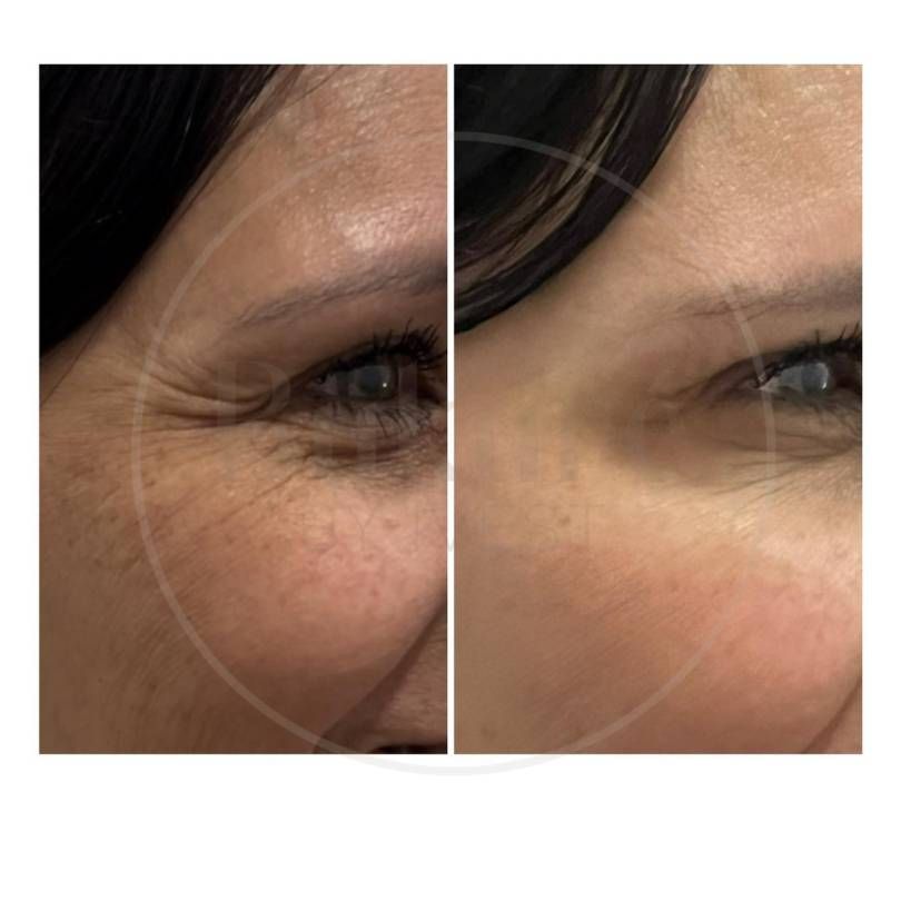 Oscar Iván Lozano Navarrete-4