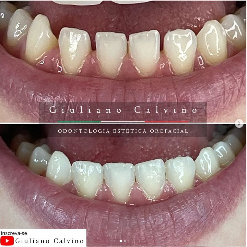 Giuliano  Calvino-11