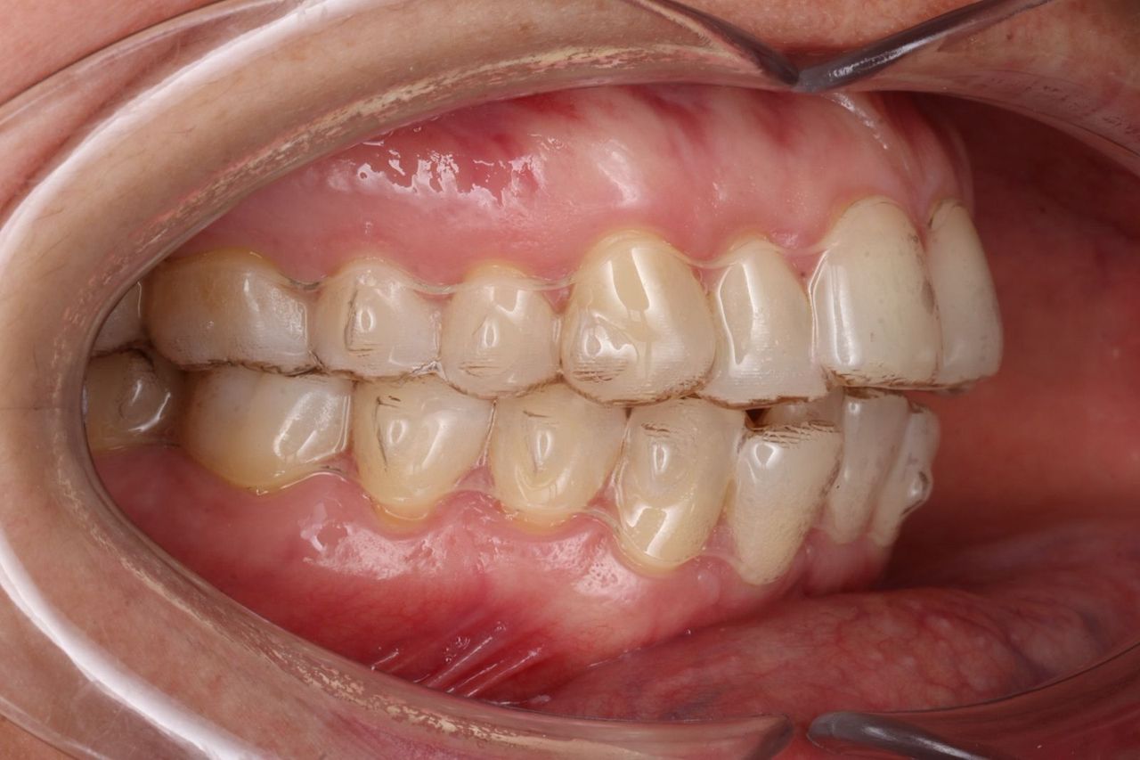 Rodrigo Hodar Dinamarca-9
