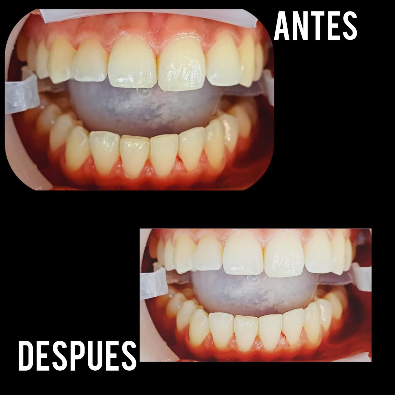 Nazinsky Rodriguez Arias-11