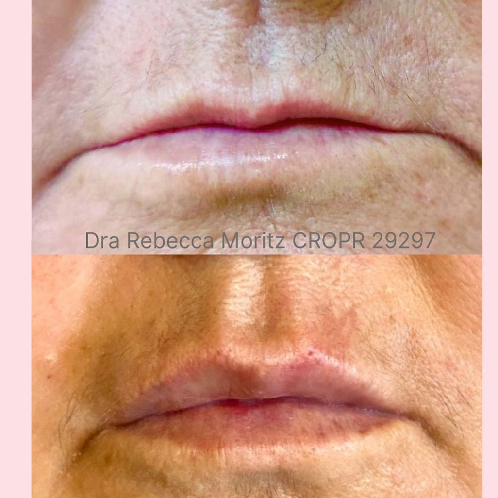 Rebecca Armelin Moritz-0