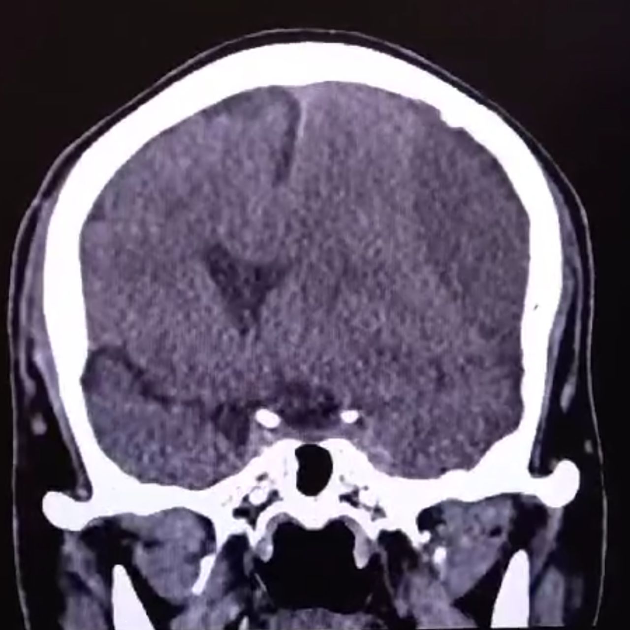 David Tafur Muñoz-1220