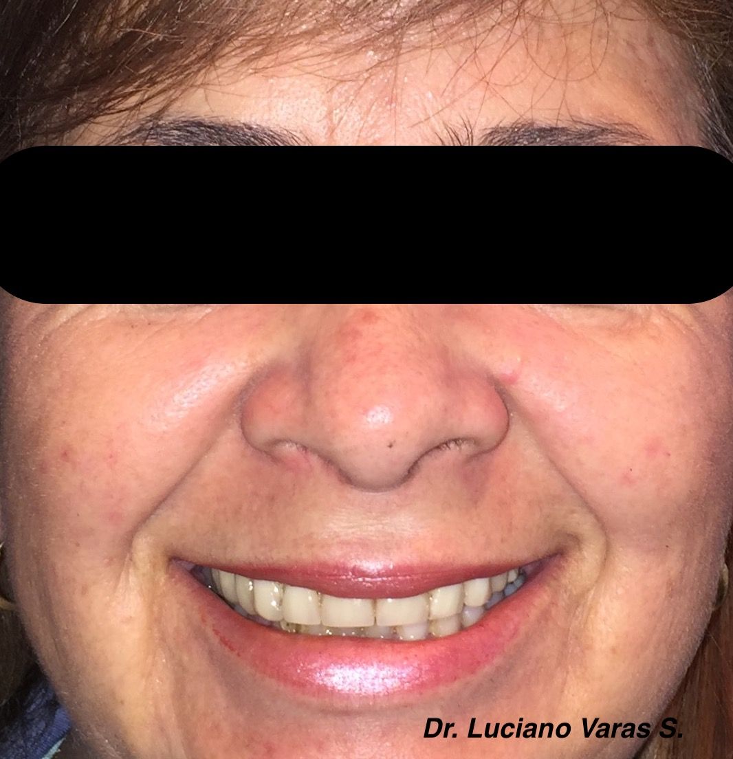 Luciano Varas Salinas-20