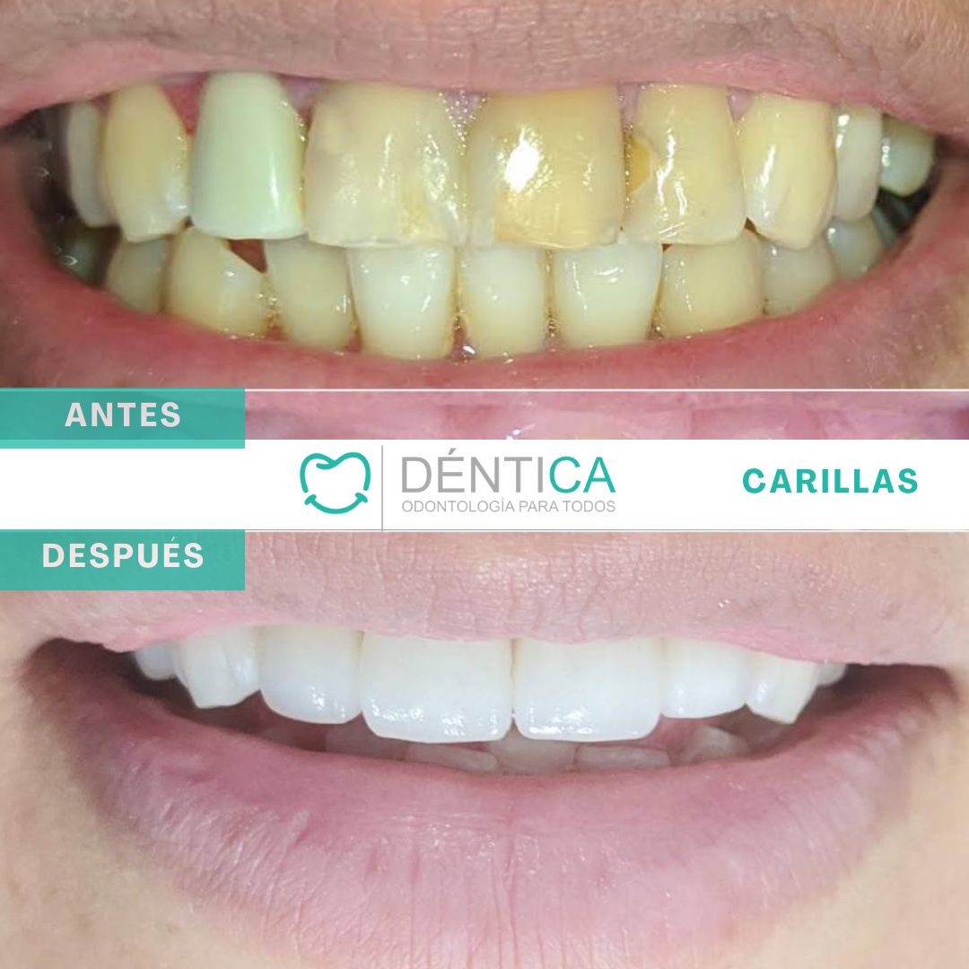 Estefani Canches Caballero-6