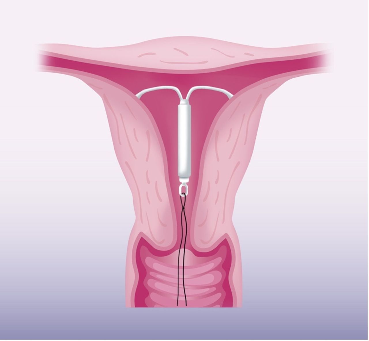 María Flor Carmona Yépez-8