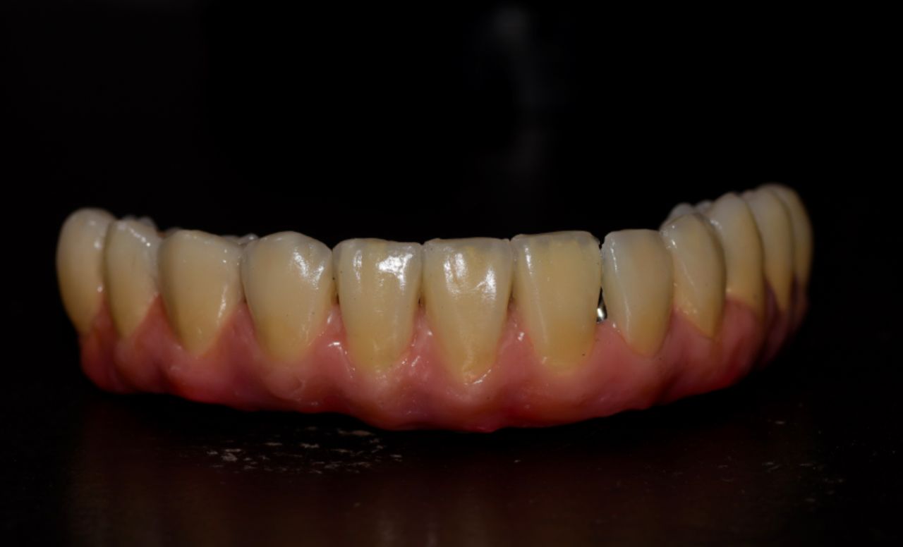 Juan Carlos Gac Pasten-12