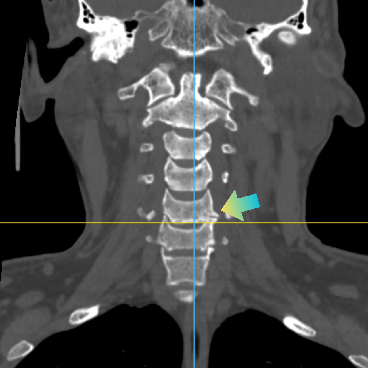 David Tafur Muñoz-2427