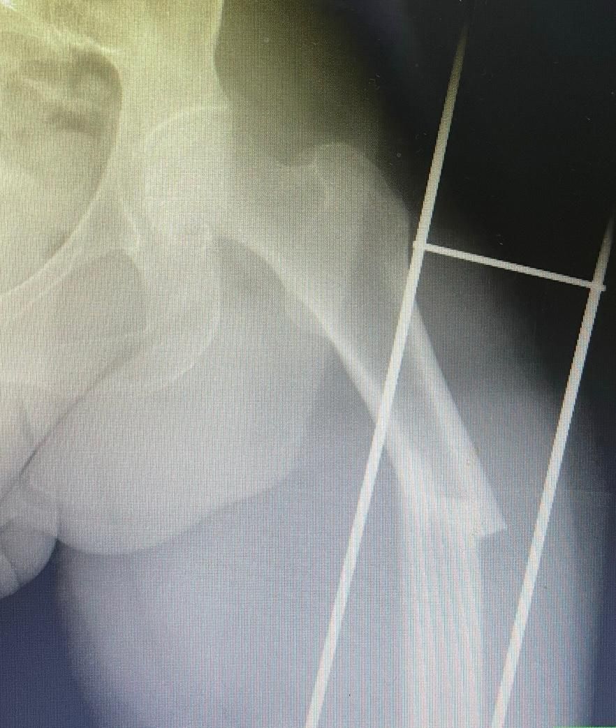 Jônatas Laurindo Giacomini-14