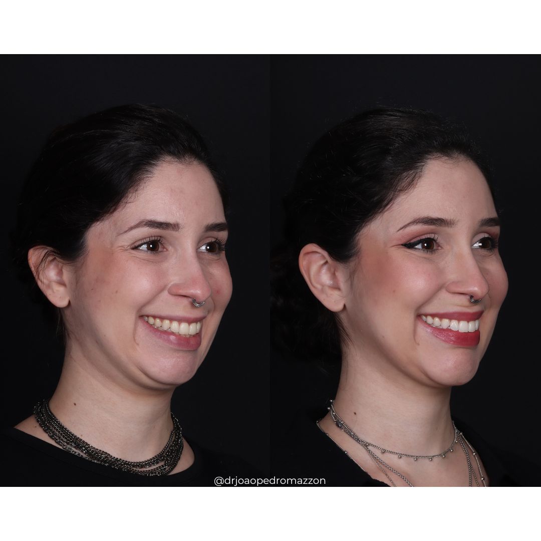 João Pedro Paulino Mazzon-26