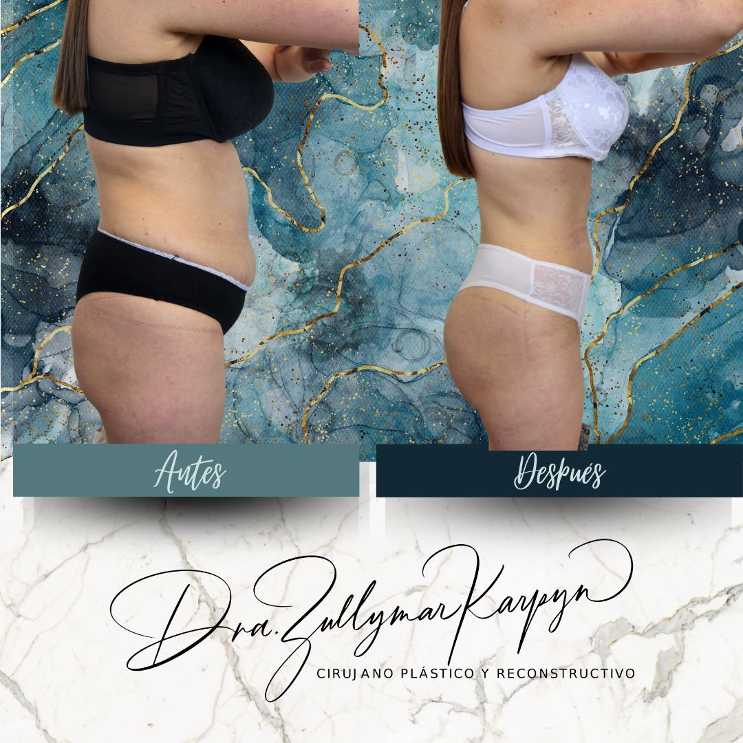 Zullymar Karpyn Brito-8