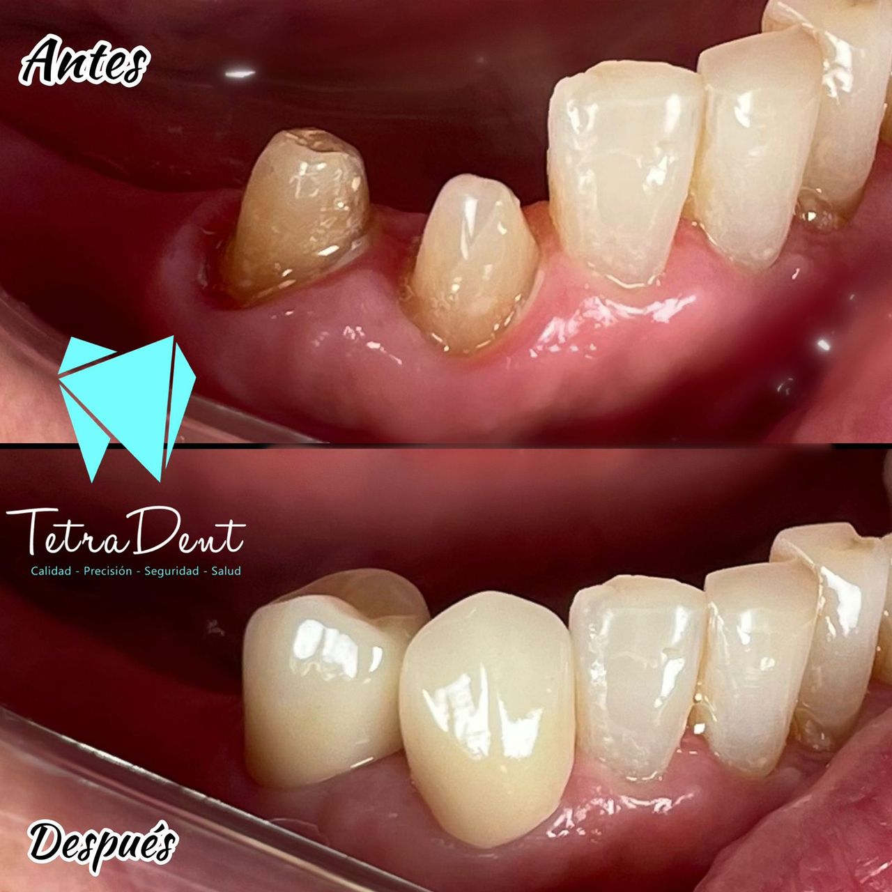 Andrés Chumbiray Rodríguez-5