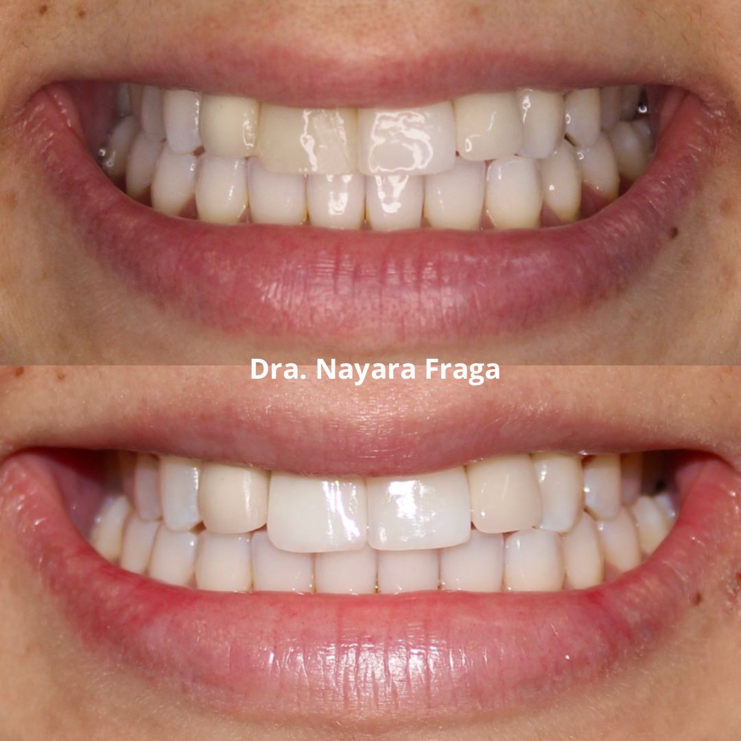 Nayara Fraga De Miranda-13