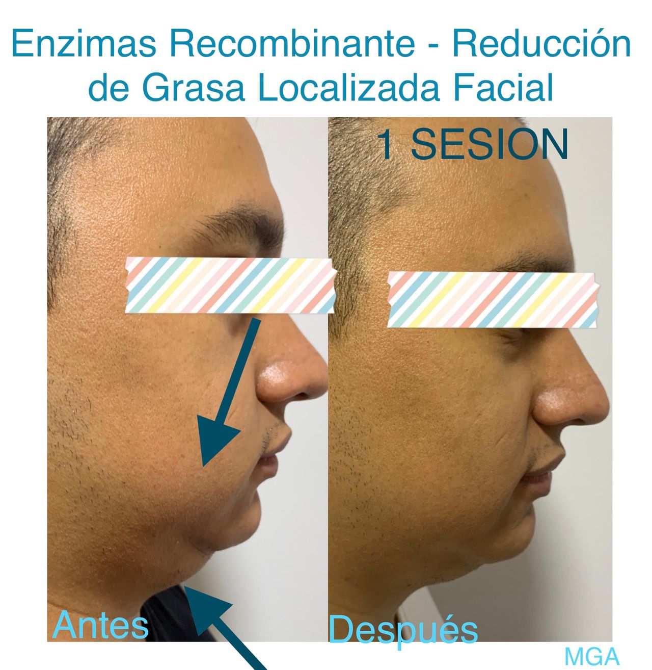 Maria Gisela Angel Losada-10