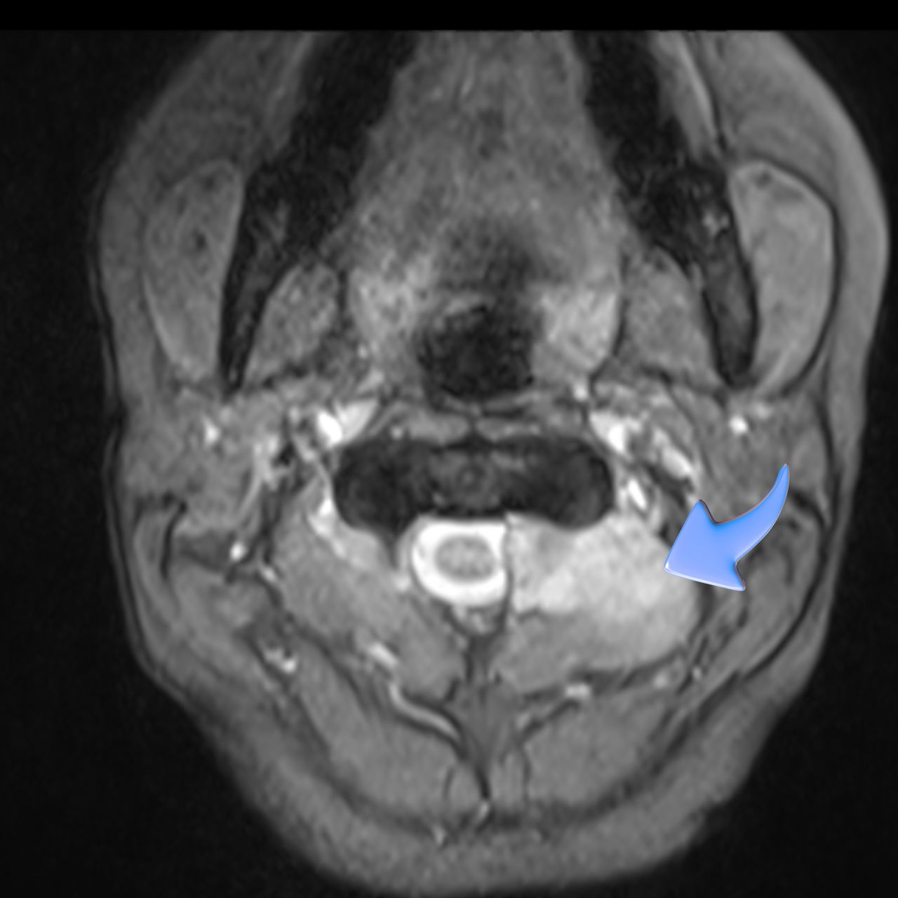 David Tafur Muñoz-1675