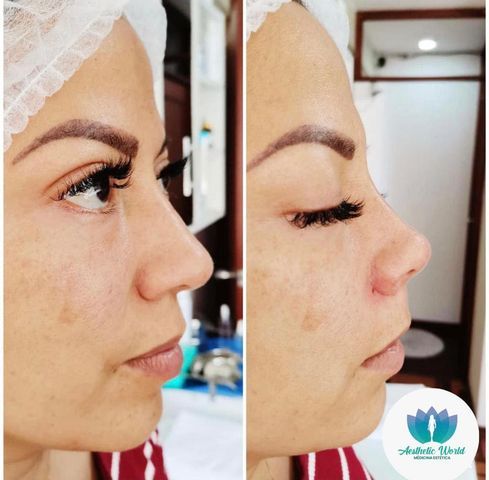 Jhonatan Oyola Farfán-23