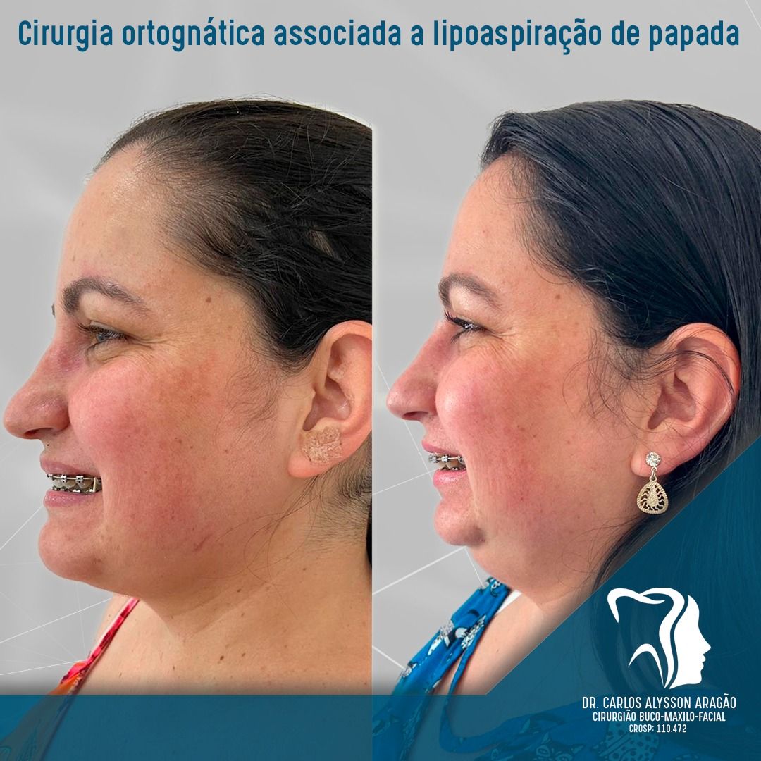 Carlos Alysson Aragão-25