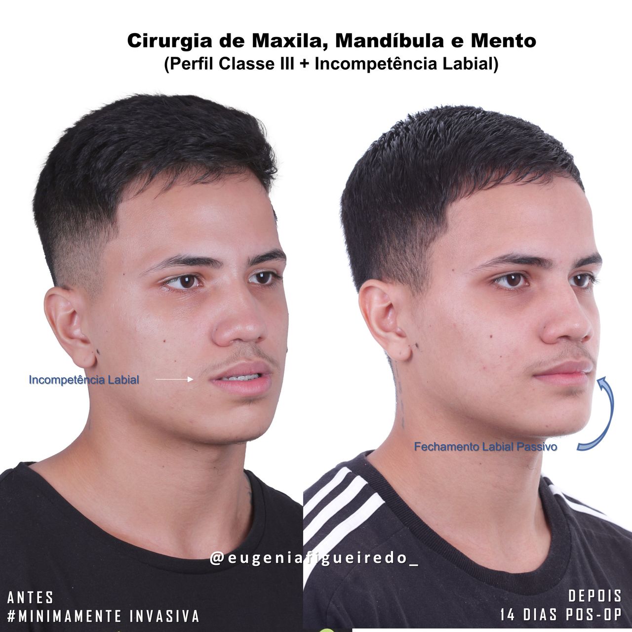 Eugênia Figueiredo-7