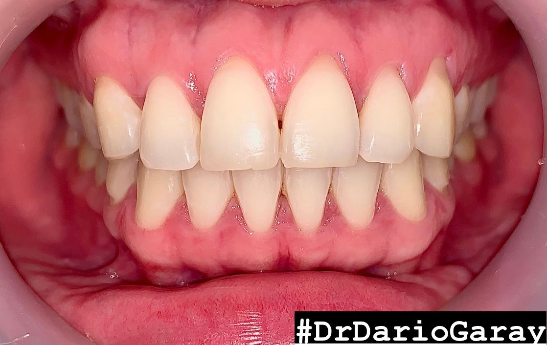 Dario Antonio Garay Chaustre-13