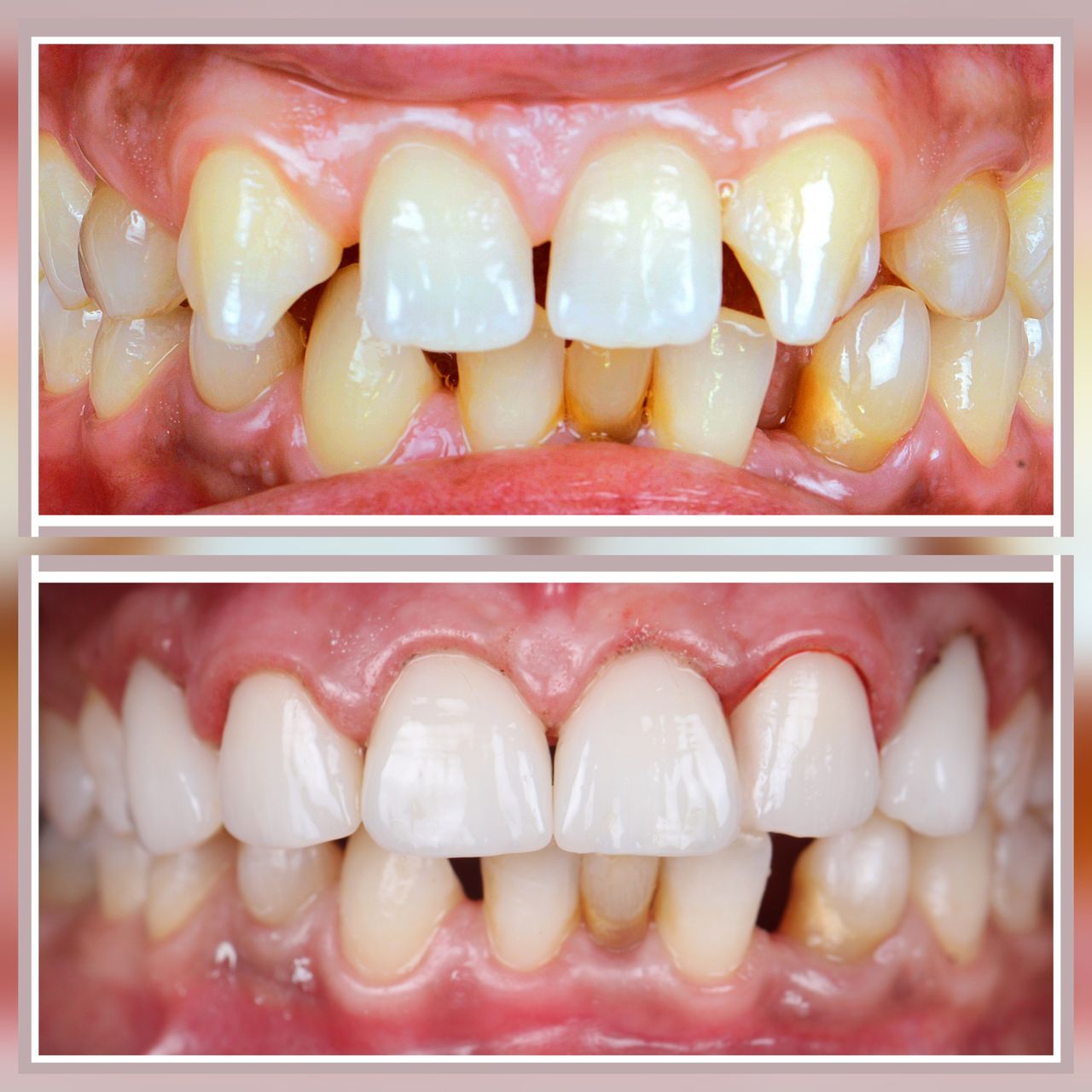 Ana Virginia  Pinheiro -0