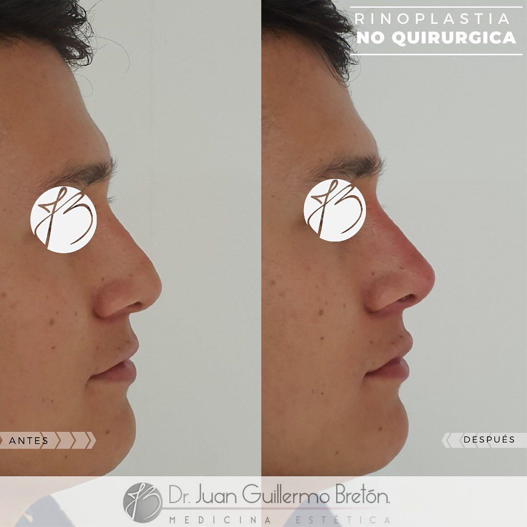 Juan Guillermo Bretón Franco-17