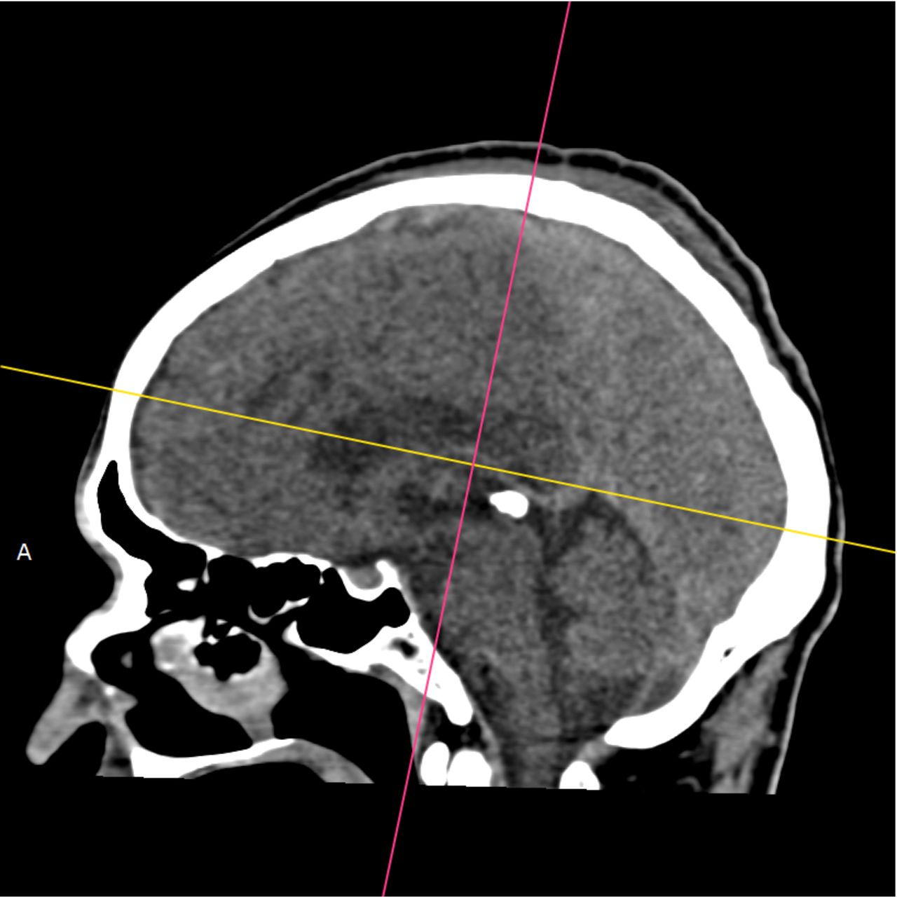 David Tafur Muñoz-1979
