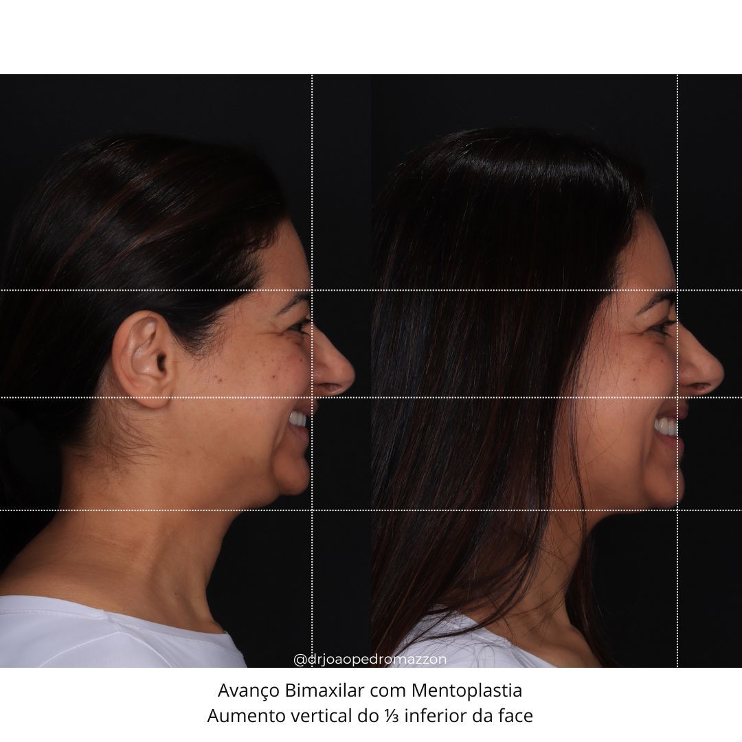 João Pedro Paulino Mazzon-7