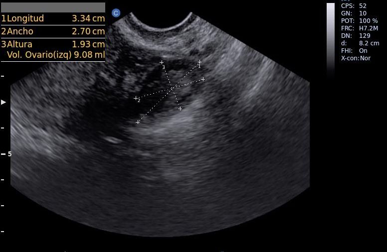 Arisev Maria Figueroa Ramos-4