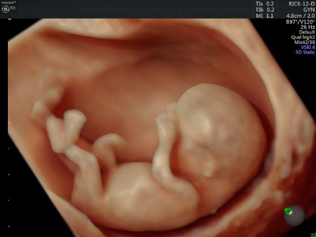 Raul Javier Banderas Pumarino-13