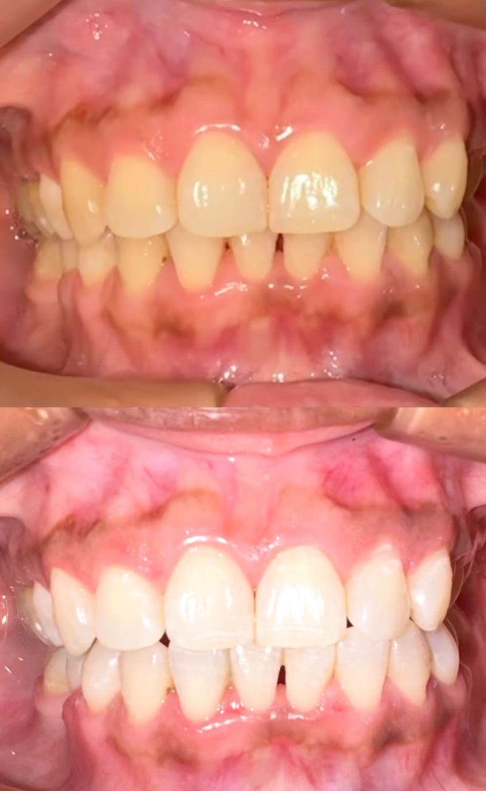 Joel Anderson Valverde Rebaza-1