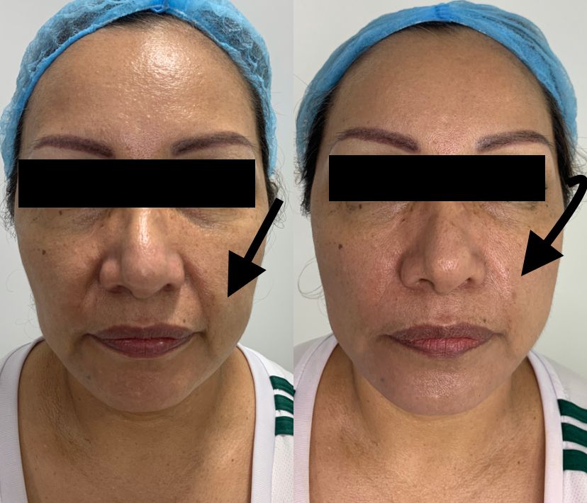 Maria Gisela Angel Losada-4