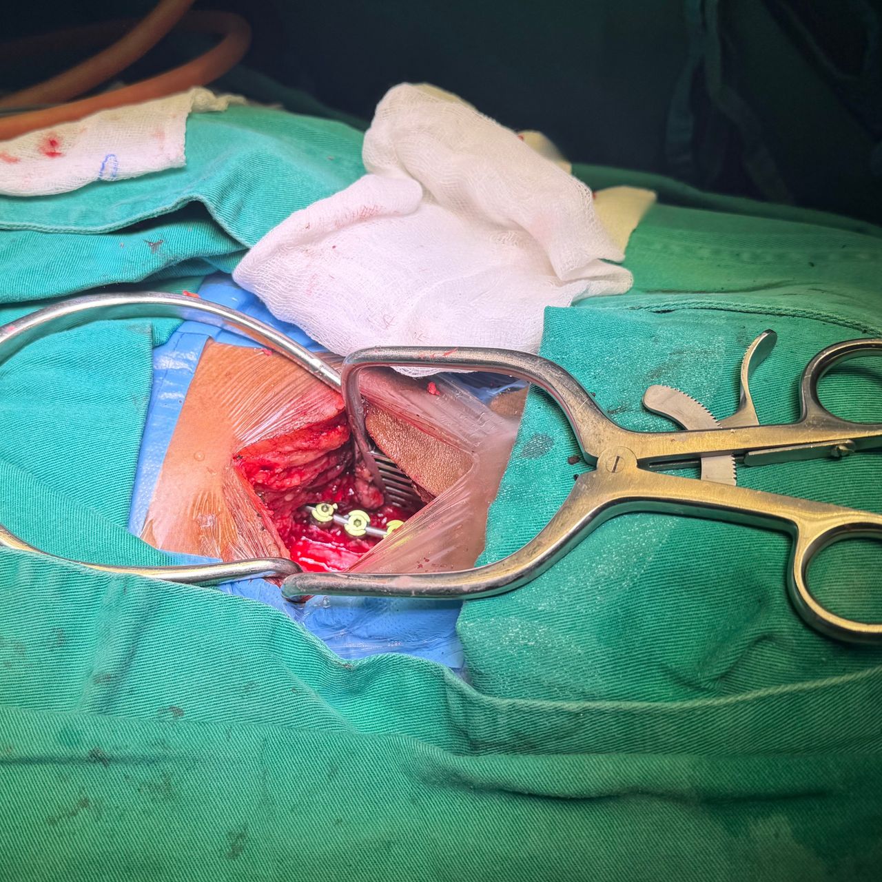 David Tafur Muñoz-2422